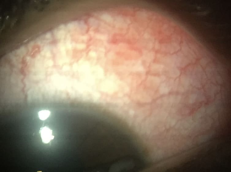 hospital in Virugambakkam