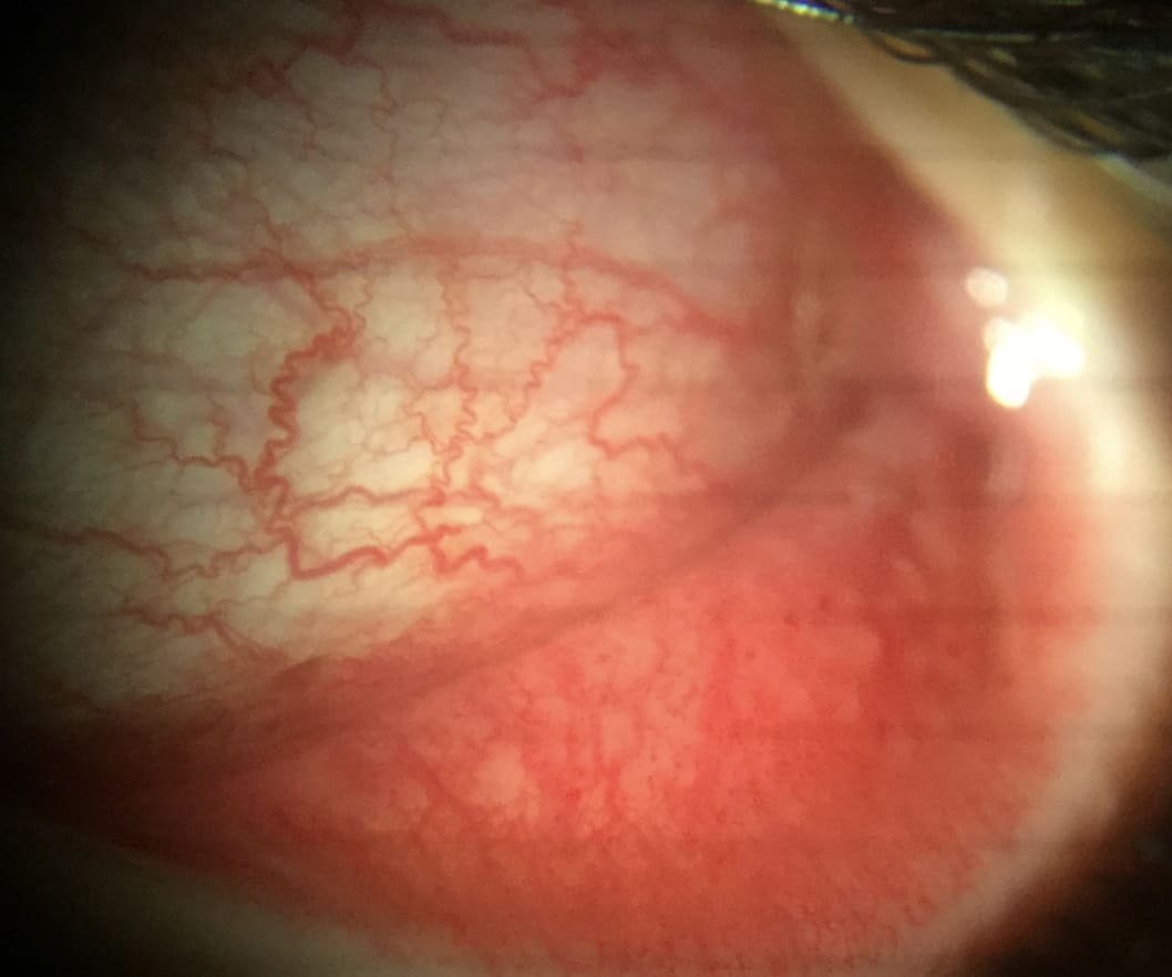 hospital in Virugambakkam